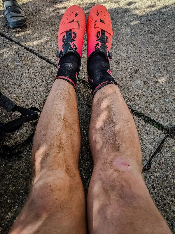 My beautiful legs after DK 100